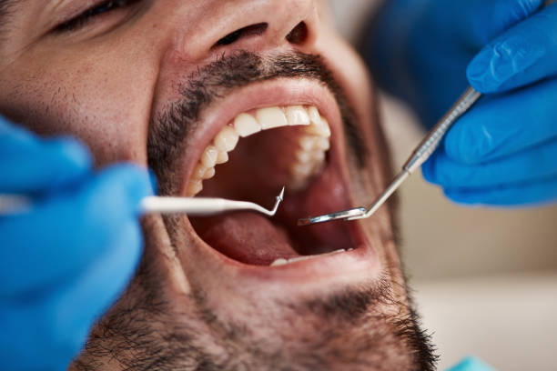 Best Veneers and Lumineers  in Poplarville, MS